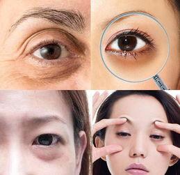 日本增大双眼,揭秘日本增大双眼的神奇秘籍